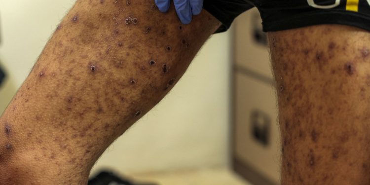 Palestinians released by Israel show signs of ‘torture, starvation’