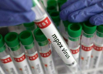 Sindh reports first case of mpox: health ministry