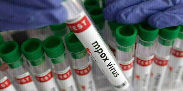 Sindh reports first case of mpox: health ministry