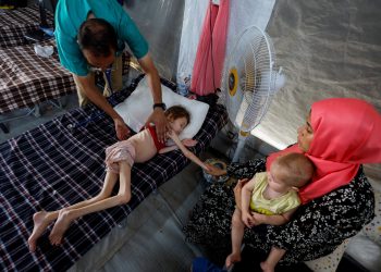 At least 66 children dead of malnutrition in Gaza amid Israel’s war