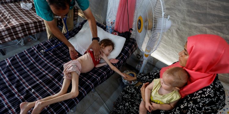 At least 66 children dead of malnutrition in Gaza amid Israel’s war