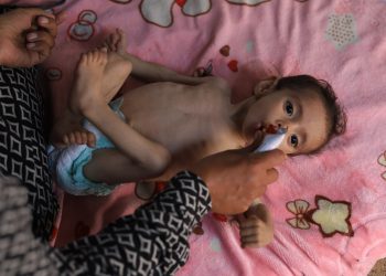UN warns of surge in acute malnutrition among Gaza’s young children