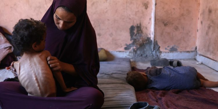 Amid Gaza famine, Palestinian girl struggles to survive