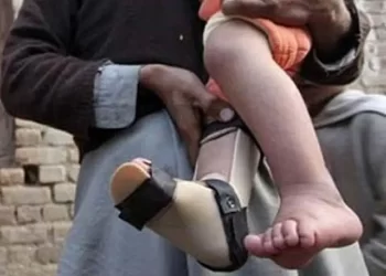 New polio case in Hyderabad takes nationwide tally to 27