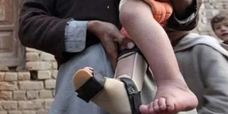 New polio case in Hyderabad takes nationwide tally to 27