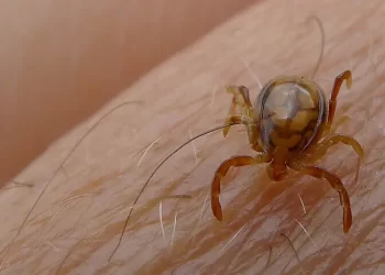 Karachi records 5th Congo fever death of the year: Sindh health dept