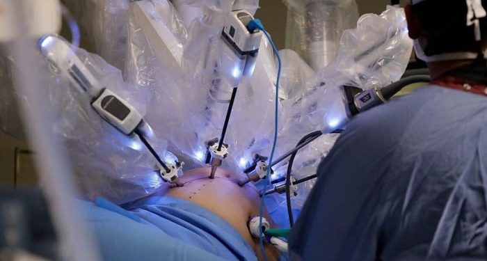 First Robotic Surgery Successfully Performed in Islamabad at PIMS Hospital