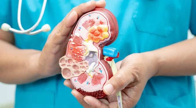 First-Ever Scar-Free Kidney Stone Surgery Performed in Pakistan